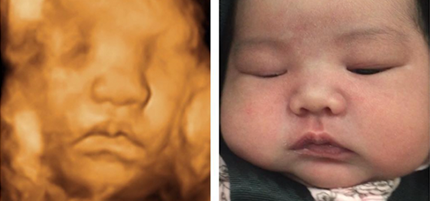 Baby and 3D Imaging
