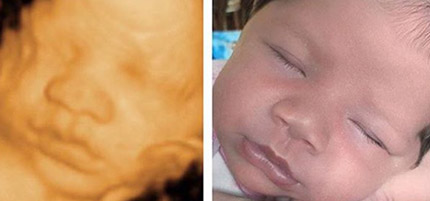 Baby and 3D Imaging