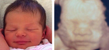 Baby and 3D Imaging