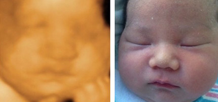 Baby and 3D Imaging