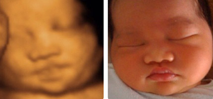 Baby and 3D Imaging