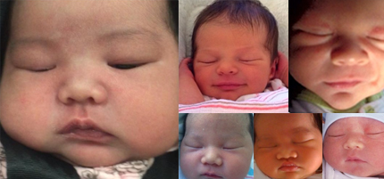 Baby and 3D Imaging