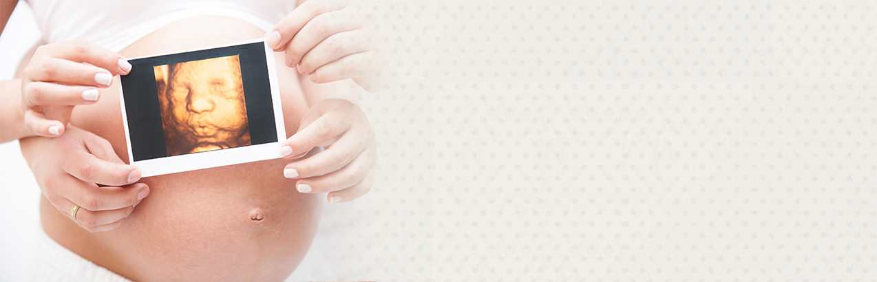 Praganent lady holding 3D ultrasound image